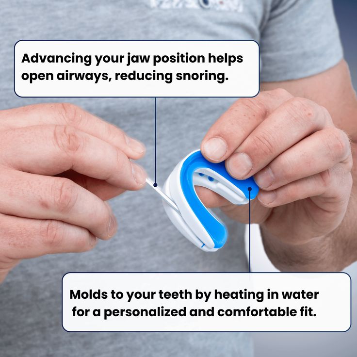 NoSnoreX™ Anti-Snoring Mouthpiece