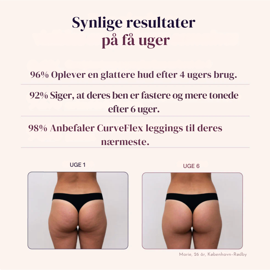 CurveFlex™ Leggings