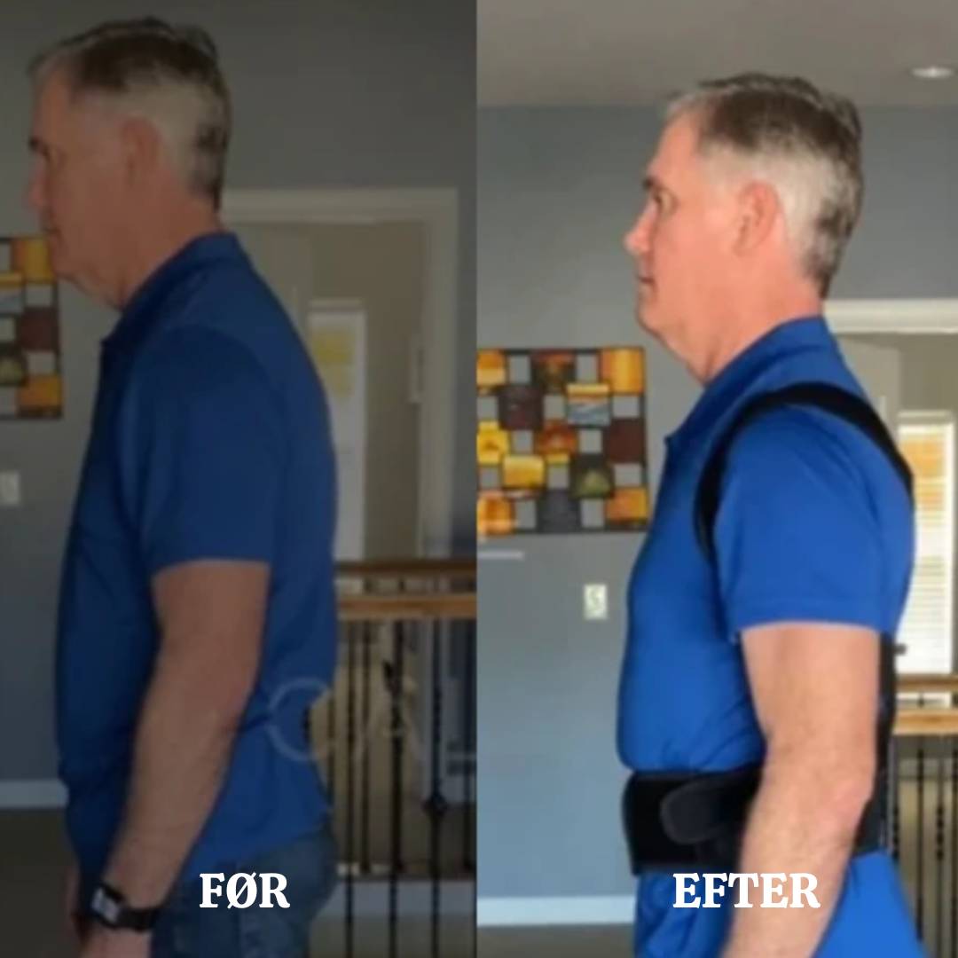 SpineAlign™ Holdningskorrigerer